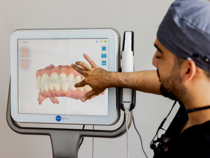 At-Home Teeth Whitening Kit from Smile with George London
